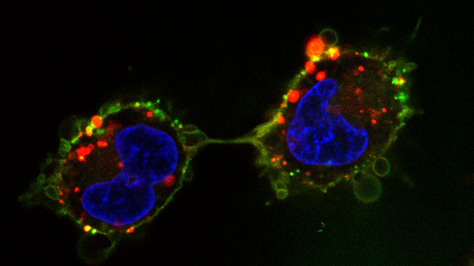 Human osteosarcoma cells labeled with fluorescent dyes, including one of Raymo’s photoswitchable dyes, which glows green to illuminate the plasma membrane. Photo: University of Miami Laboratory for Molecular Photonics